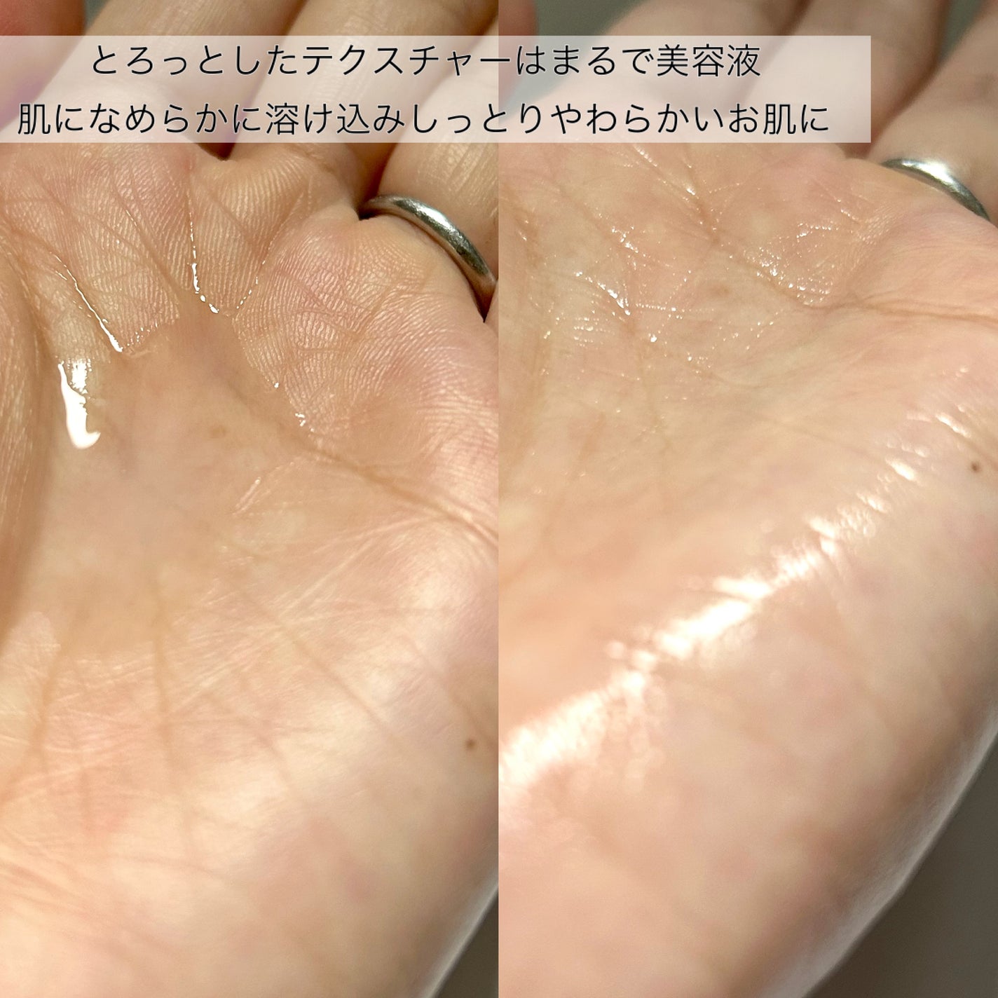 グルタチオンアンプルトナー/SKIN&LAB/化粧水を使ったクチコミ(4枚目)