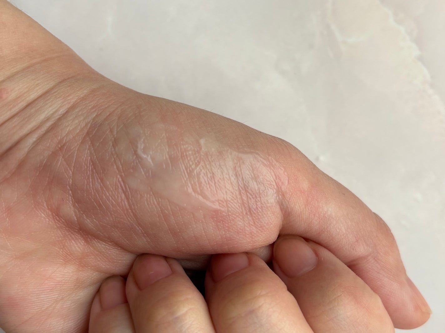 アトバリア365 ハイドロクリーム /AESTURA/フェイスクリームを使ったクチコミ(3枚目)