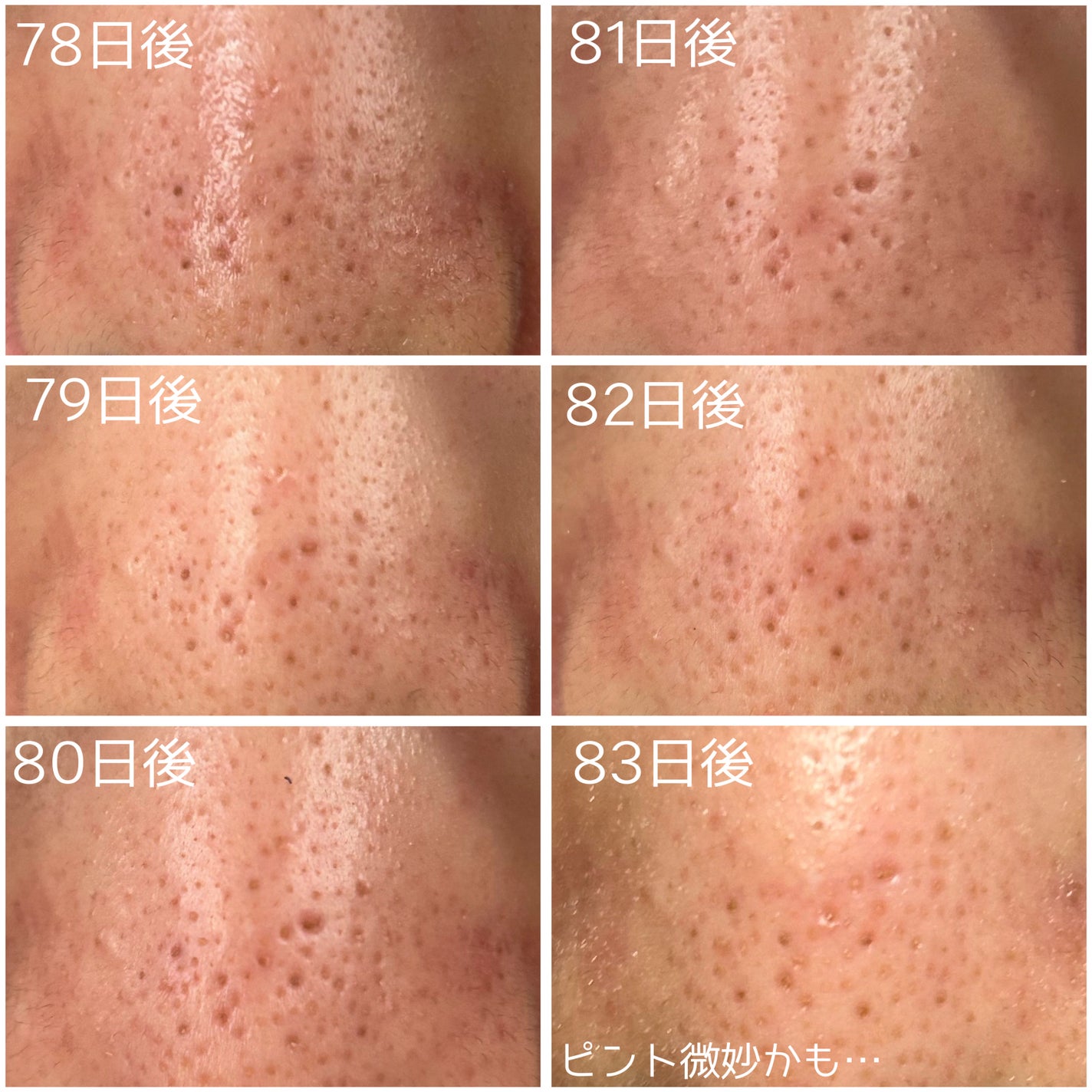 レチノール0.3 ナイアシンリニューイングセラム/Anua/美容液を使ったクチコミ(2枚目)