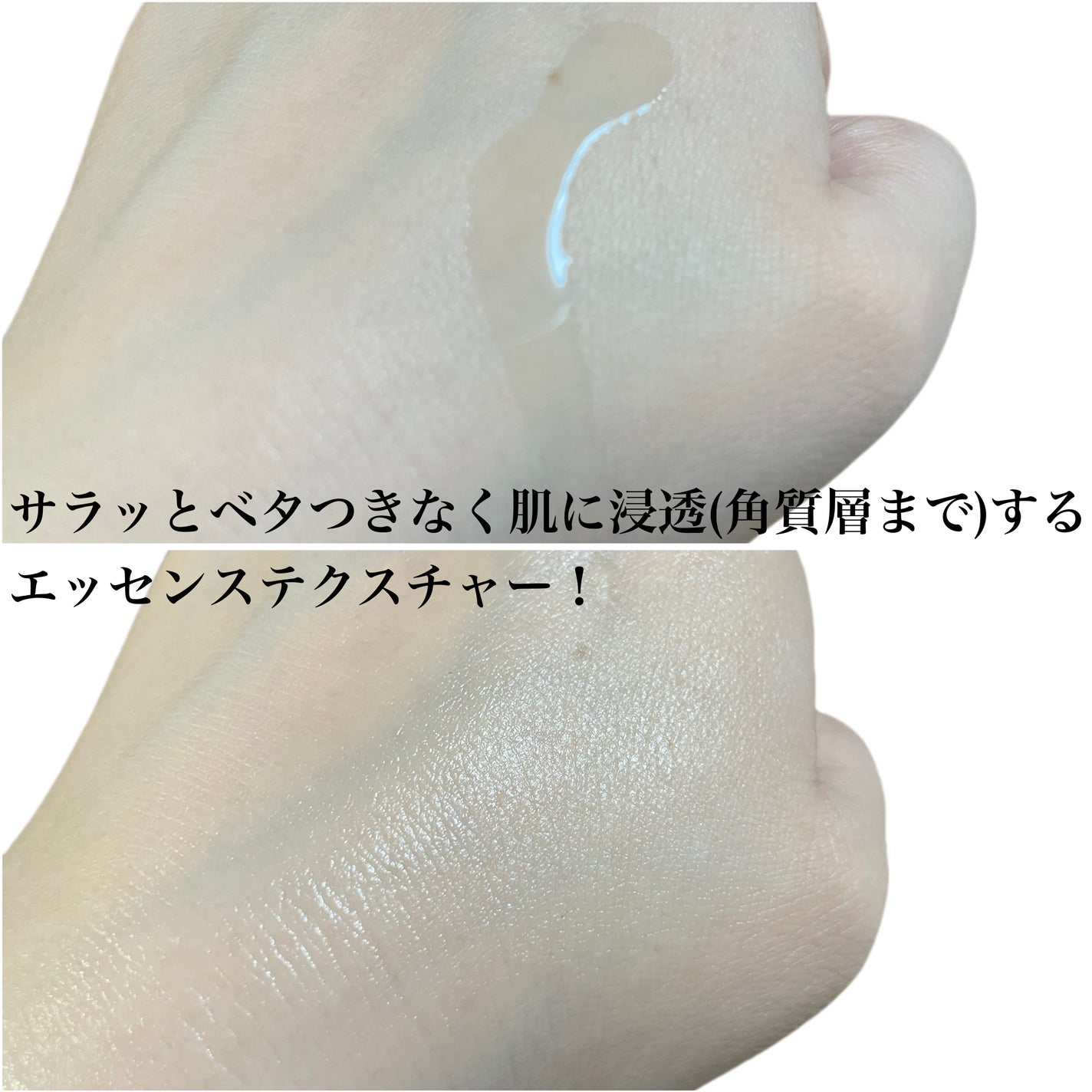 natsumi on LIPS 「夏にピッタリ朝用ビタミン美容液/SKNREMED(スキンリメド..」(6枚目)