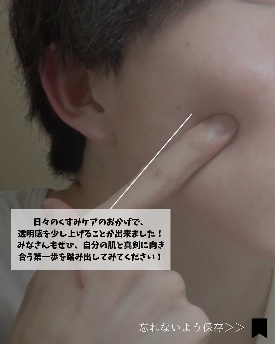 ディープ メラケア 美容液/Mildlab/美容液を使ったクチコミ(7枚目)