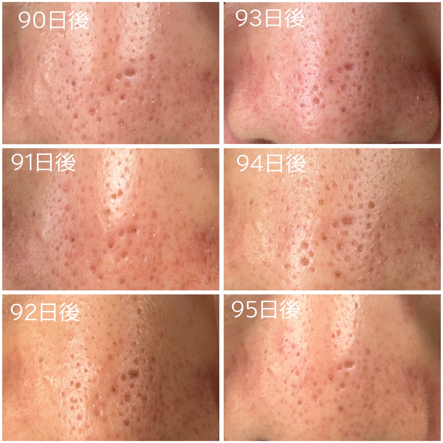 レチノール0.3 ナイアシンリニューイングセラム/Anua/美容液を使ったクチコミ(4枚目)