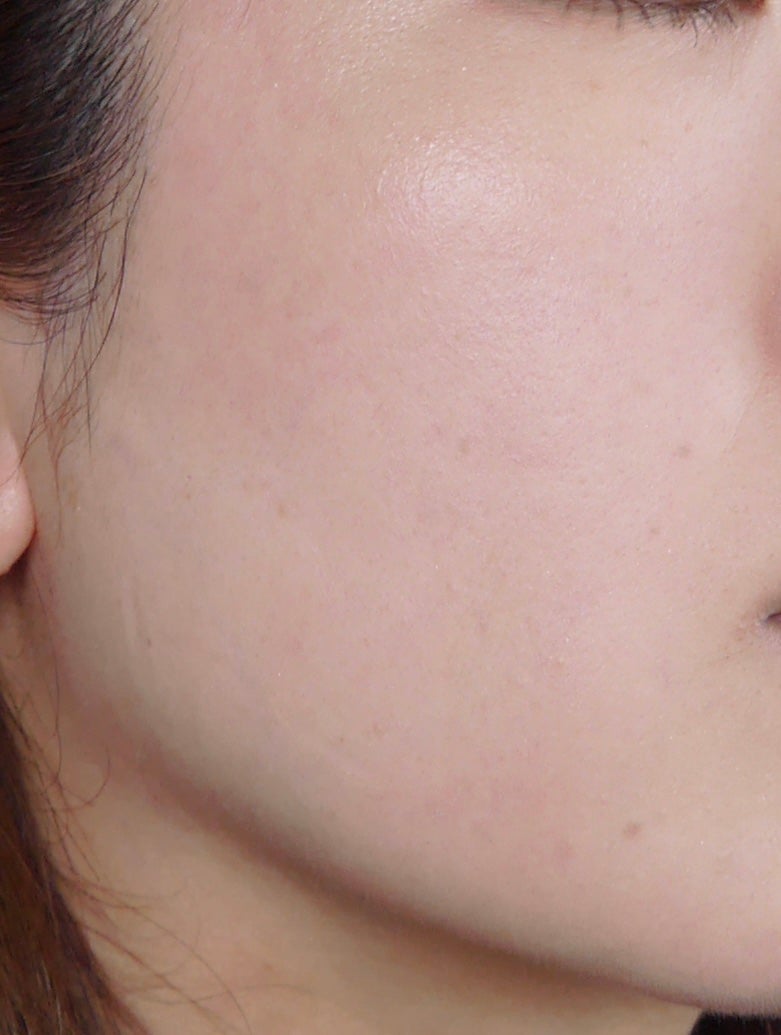 タンイドル ウルトラ ウェア リキッド N/LANCOME/リキッドファンデーションを使ったクチコミ(5枚目)