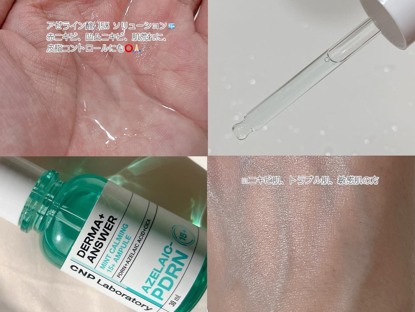 ダーマアンサーアゼライン酸ミントアンプル/CNP Laboratory/美容液を使ったクチコミ(3枚目)