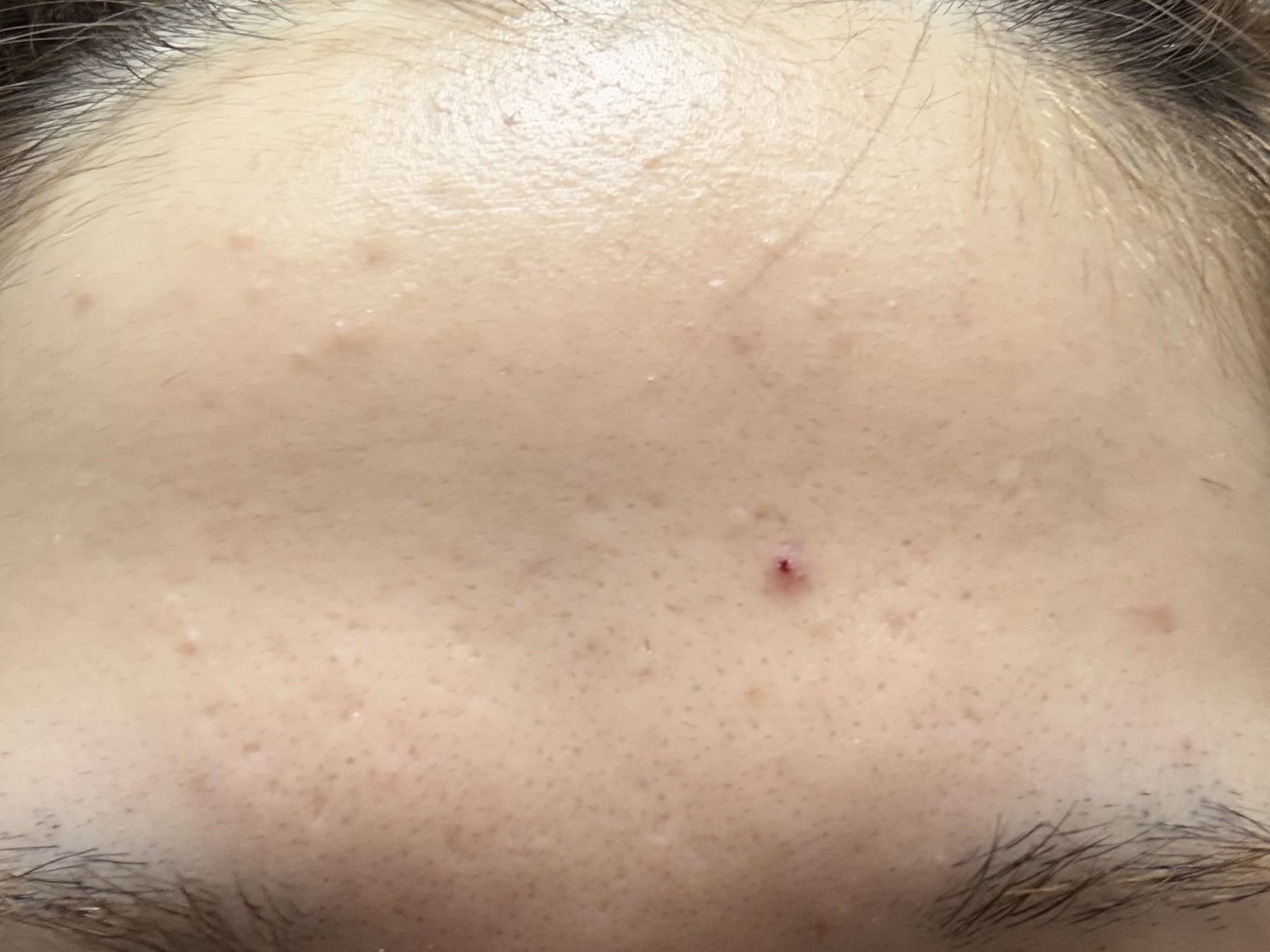 潤浸保湿 化粧水 III とてもしっとり/キュレル/化粧水を使ったクチコミ（3枚目）