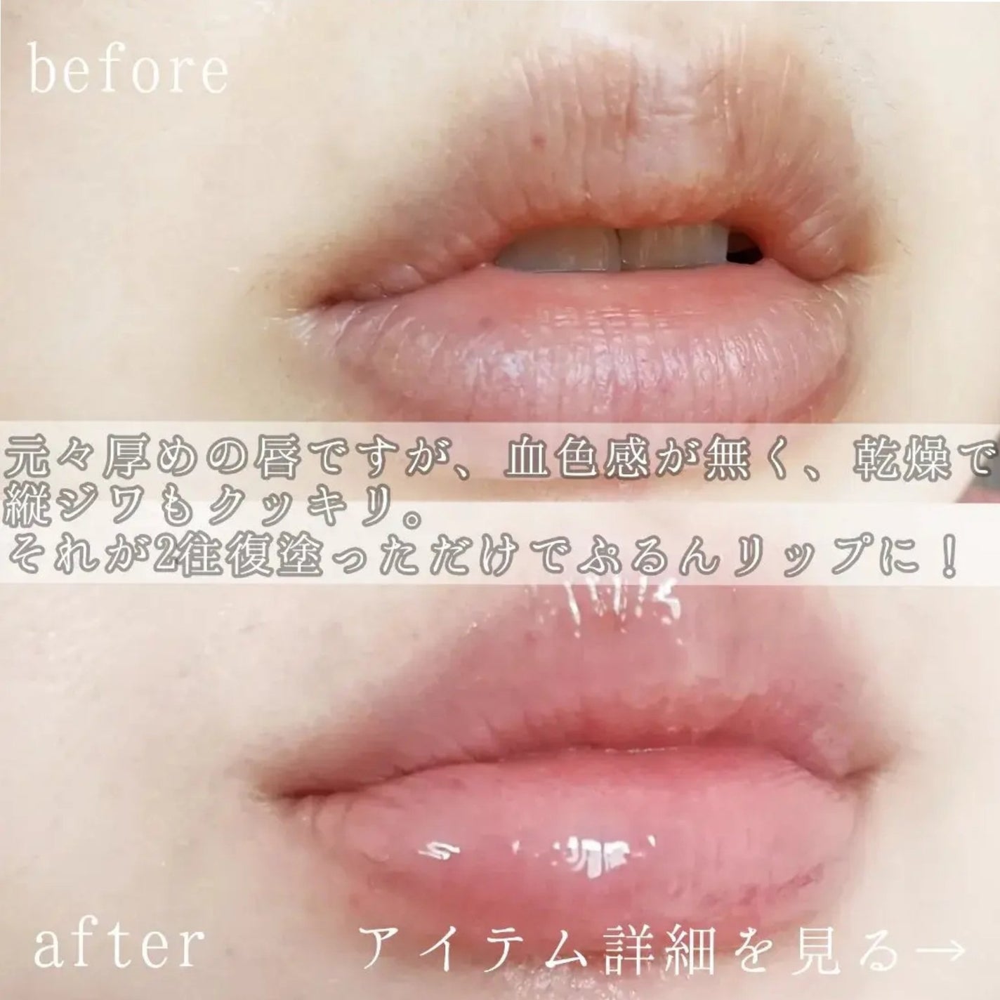 エッセンス リッププランパー/Visée/リッププランパーを使ったクチコミ(2枚目)