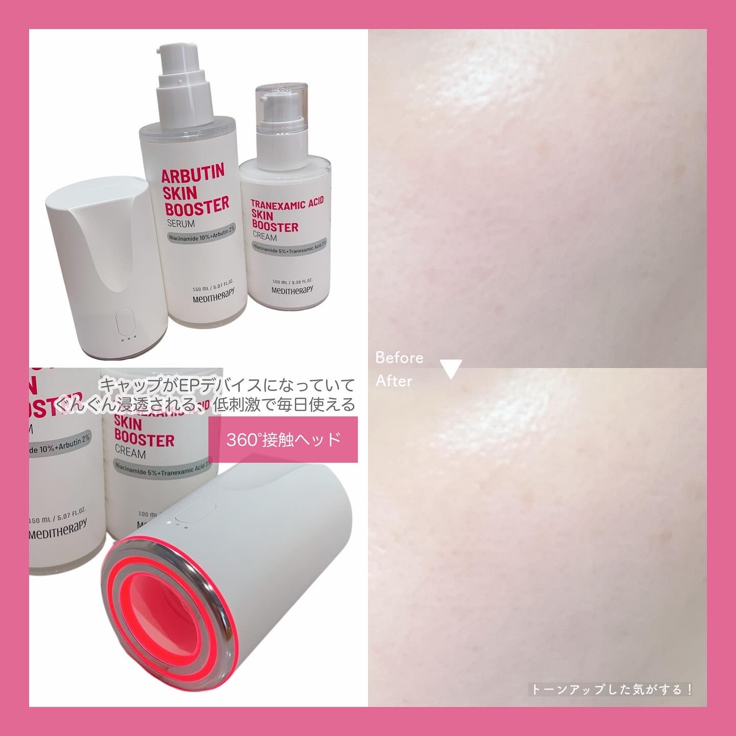トラネキサム酸スキンブースタークリーム/MEDITHERAPY/フェイスクリームを使ったクチコミ（3枚目）