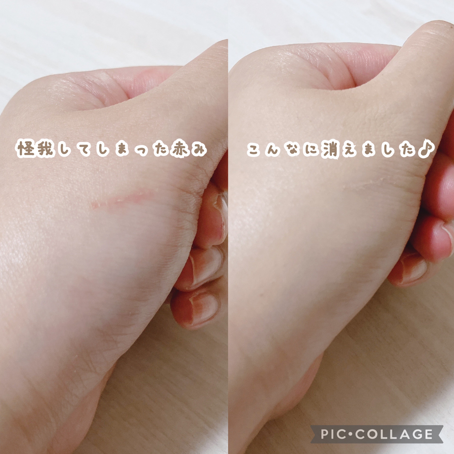 ドラマティックコンシーラー/マキアージュ/クリームコンシーラーを使ったクチコミ（3枚目）