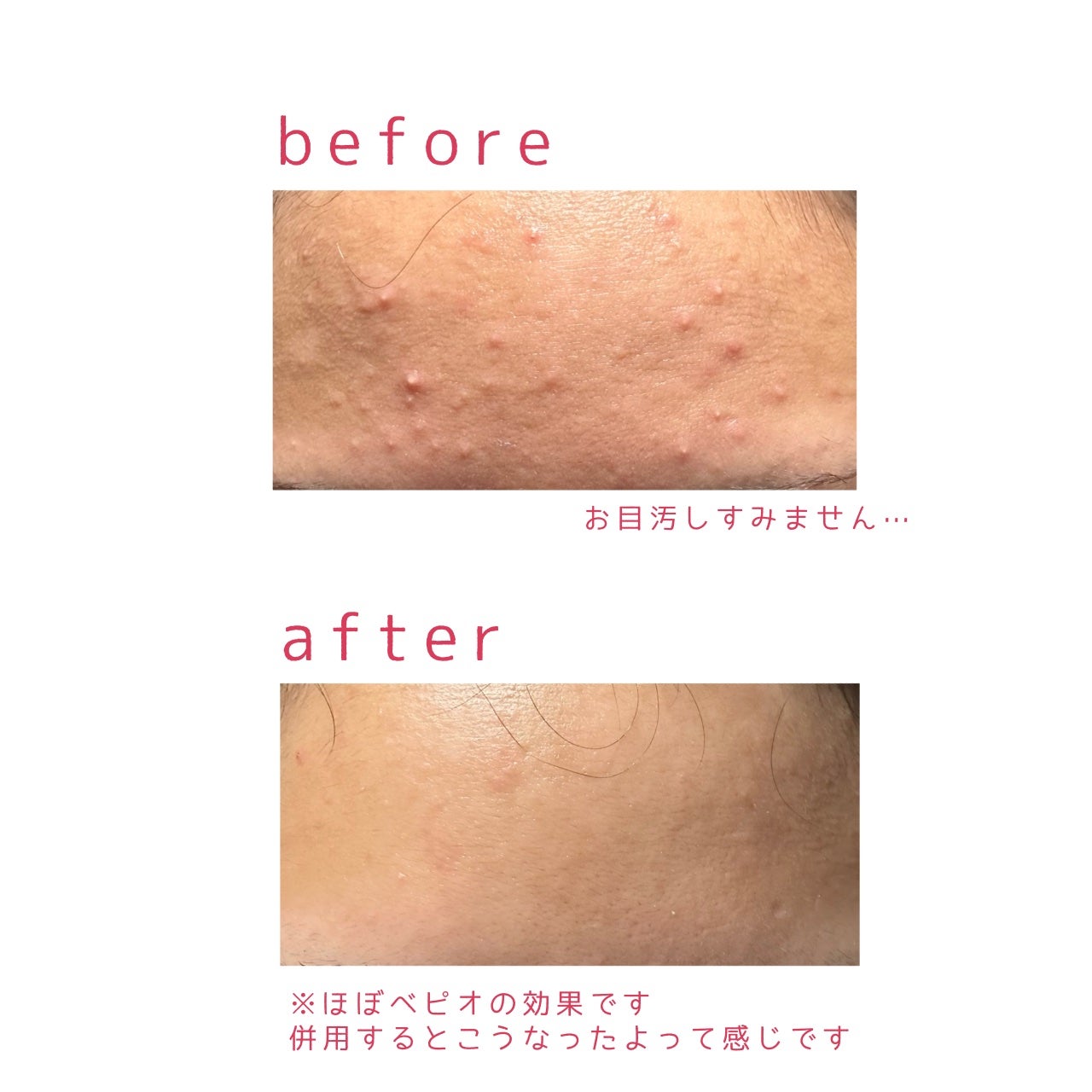 レチノール シカ リペア セラム/innisfree/美容液を使ったクチコミ(3枚目)