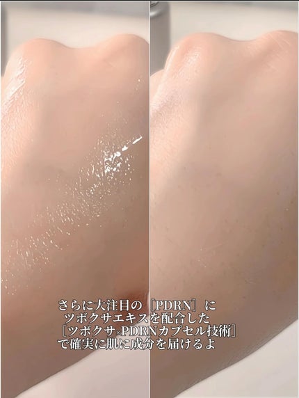 ビタ 5X PDRNセラム/D'amu/美容液を使ったクチコミ(4枚目)