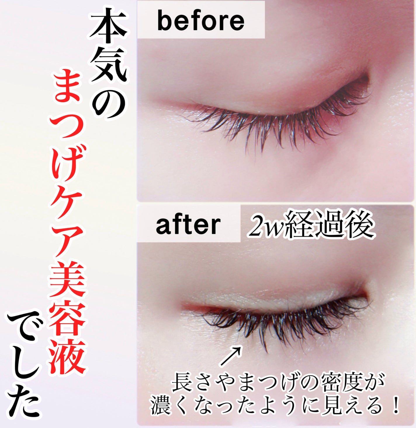 アイラッシュエッセンシャルセラム/epais/まつげ美容液を使ったクチコミ(4枚目)