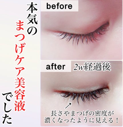 アイラッシュエッセンシャルセラム/epais/まつげ美容液を使ったクチコミ(4枚目)