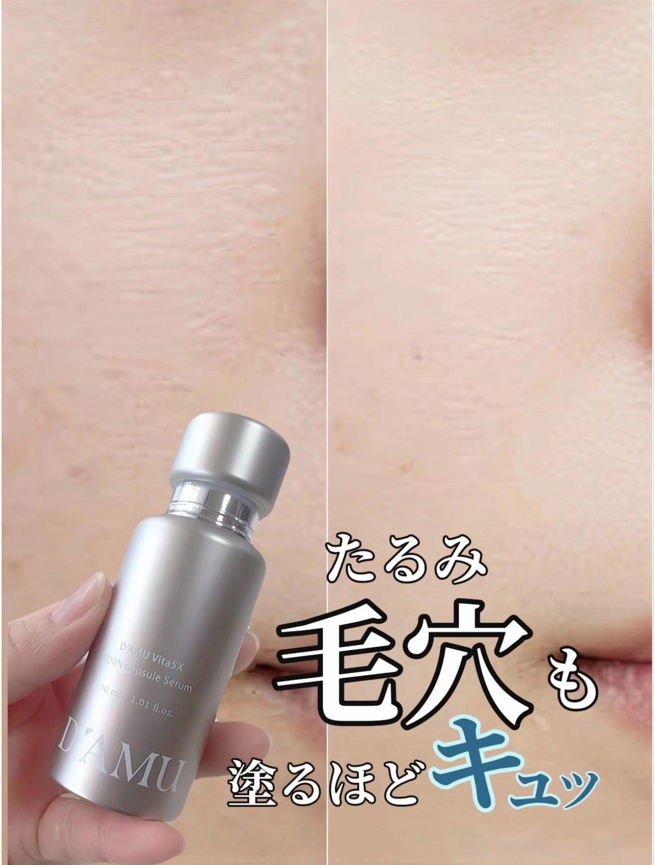 ビタ 5X PDRNセラム/D'amu/美容液を使ったクチコミ（1枚目）