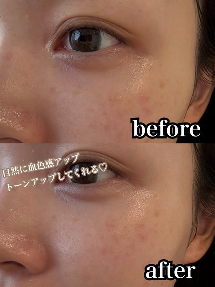 UVã€ã㢠XL ãããã¯ã·ã§ã³ããŒã³ã¢ãã ããŒãº+/ã© ããã·ã¥ ããŒ/æ¥çŒãæ¢ãã»UVã±ã¢ã䜿ã£ãã¯ãã³ãïŒ4æç®ïŒ