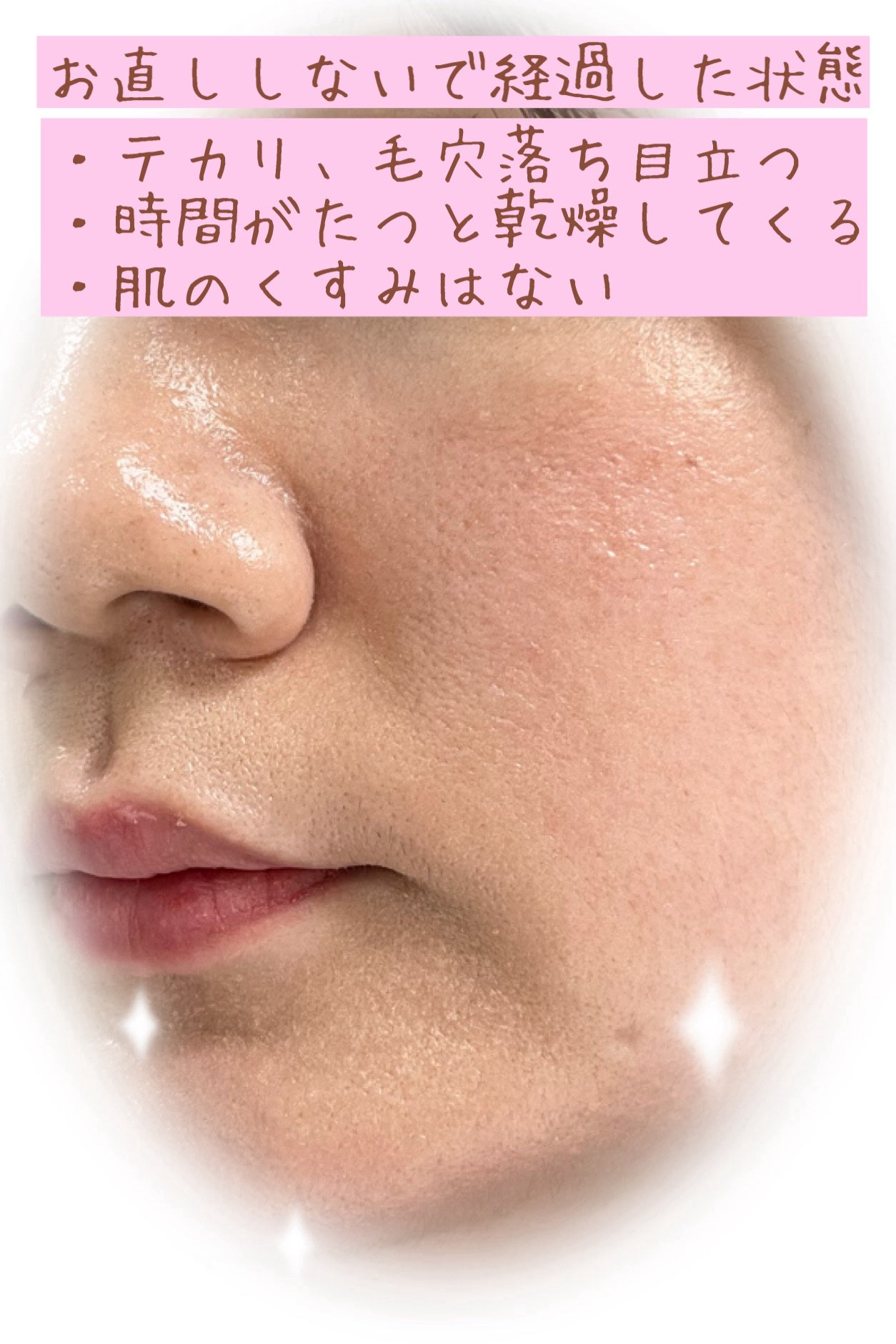 アンリミテッド ケア ツヤ セラム ファンデーション/shu uemura/リキッドファンデーションを使ったクチコミ(3枚目)