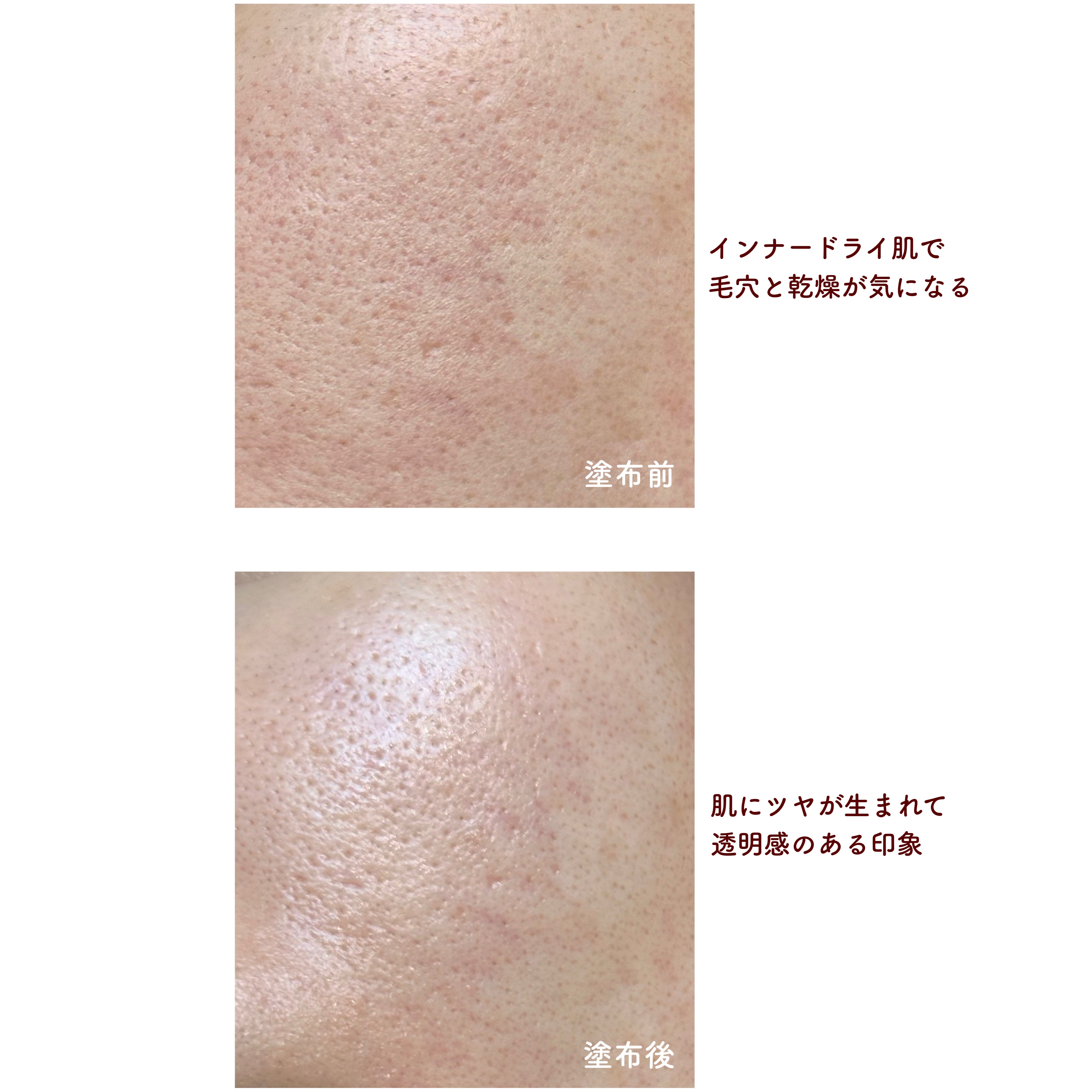 ダーマアンサーピンクトーニングトナー/CNP Laboratory/化粧水を使ったクチコミ（3枚目）