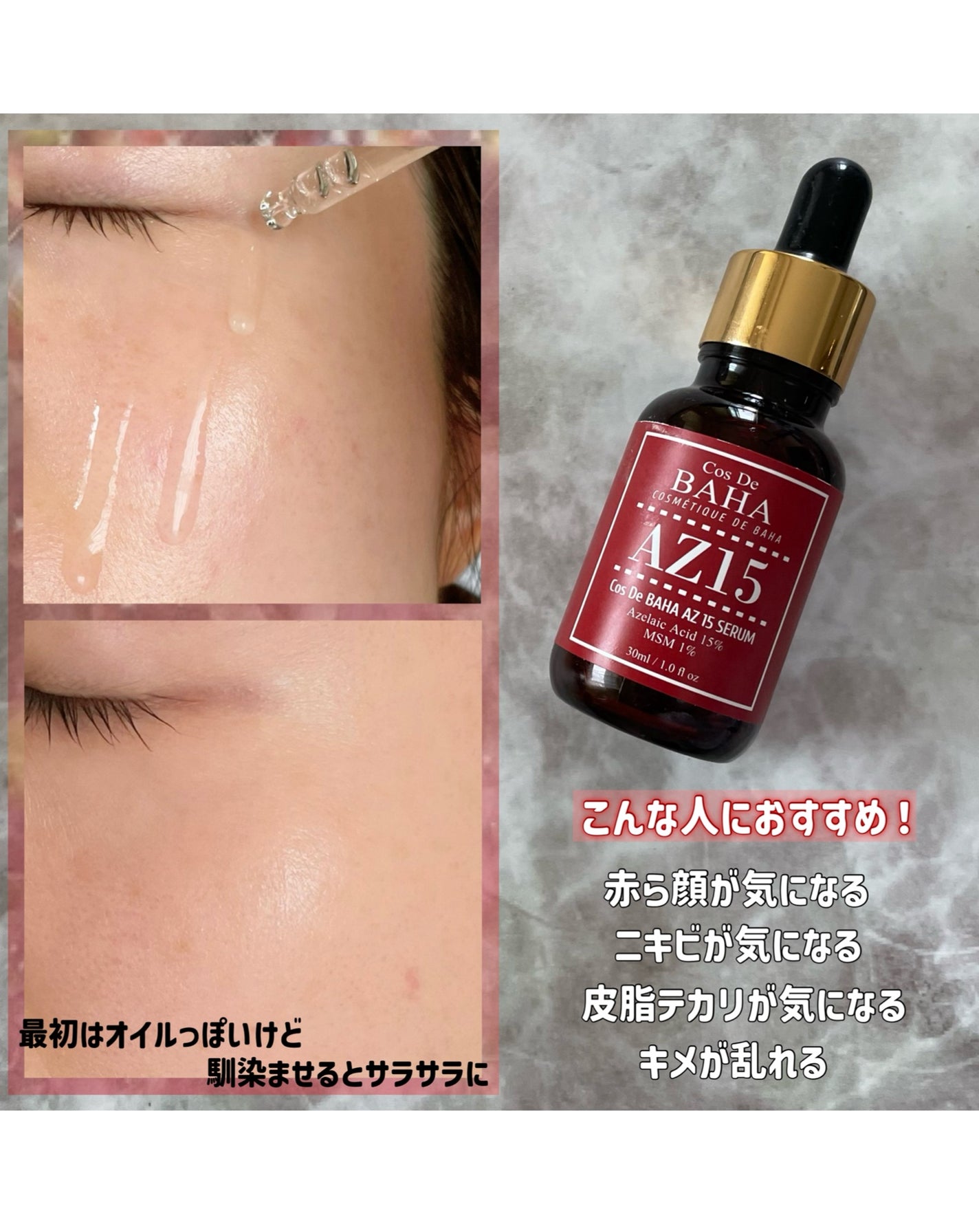 AZアゼライン酸15セラム/コスデバハ/美容液を使ったクチコミ(3枚目)