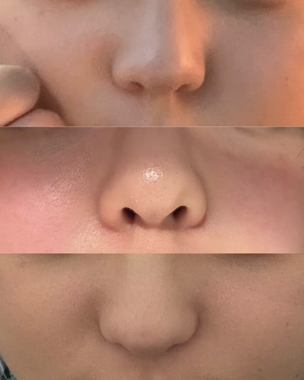 薬用カバーリキッド/クリアラスト/化粧下地を使ったクチコミ(1枚目)