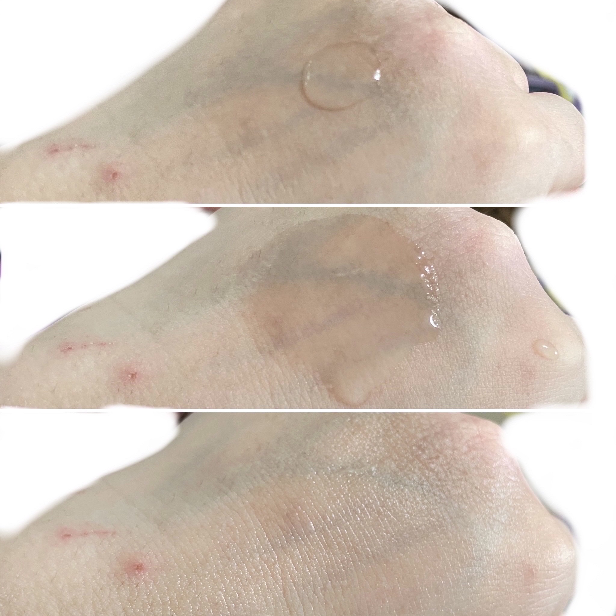 TXナイアシンエッセンストナー/SKIN&LAB/化粧水を使ったクチコミ（3枚目）