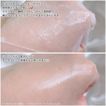 リードルS PDRN+ マスク/VT/シートマスク・パックを使ったクチコミ(4枚目)