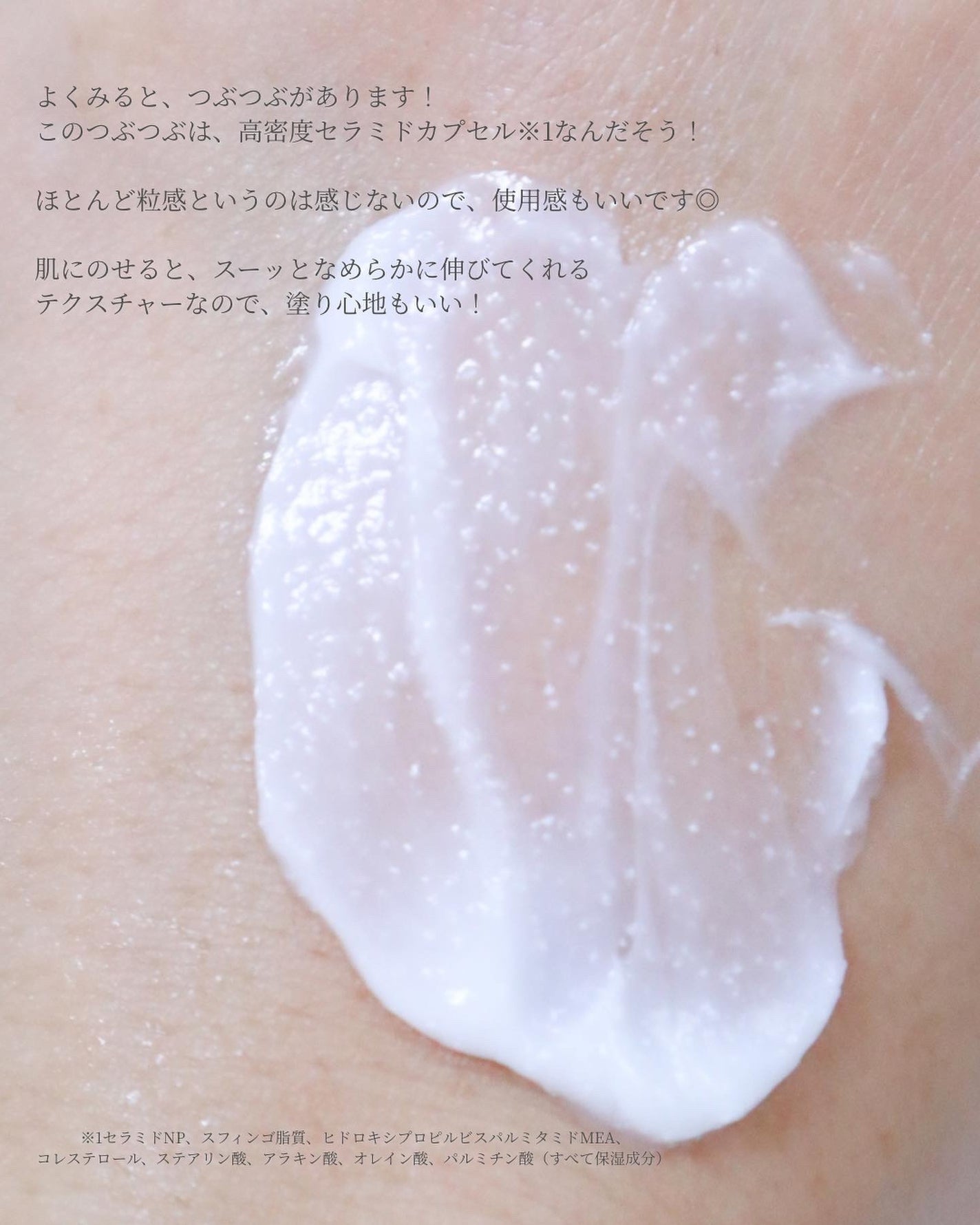 アトバリア365クリーム/AESTURA/フェイスクリームを使ったクチコミ(5枚目)