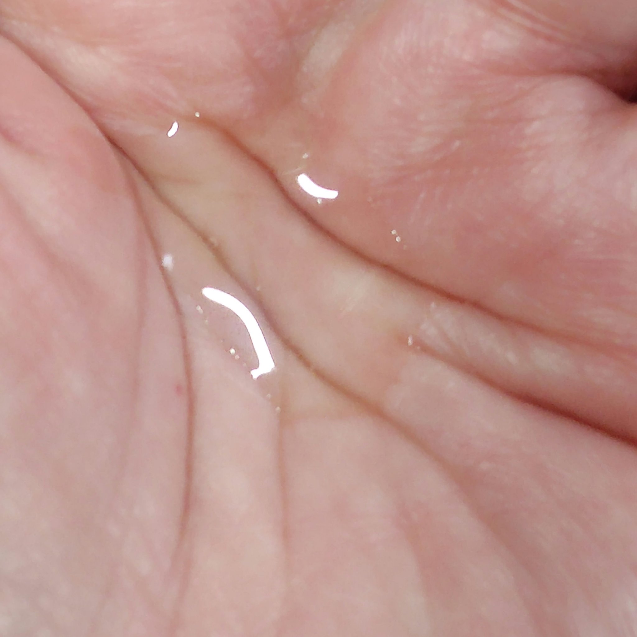 アクネケア ローション MB/d プログラム/化粧水を使ったクチコミ（3枚目）