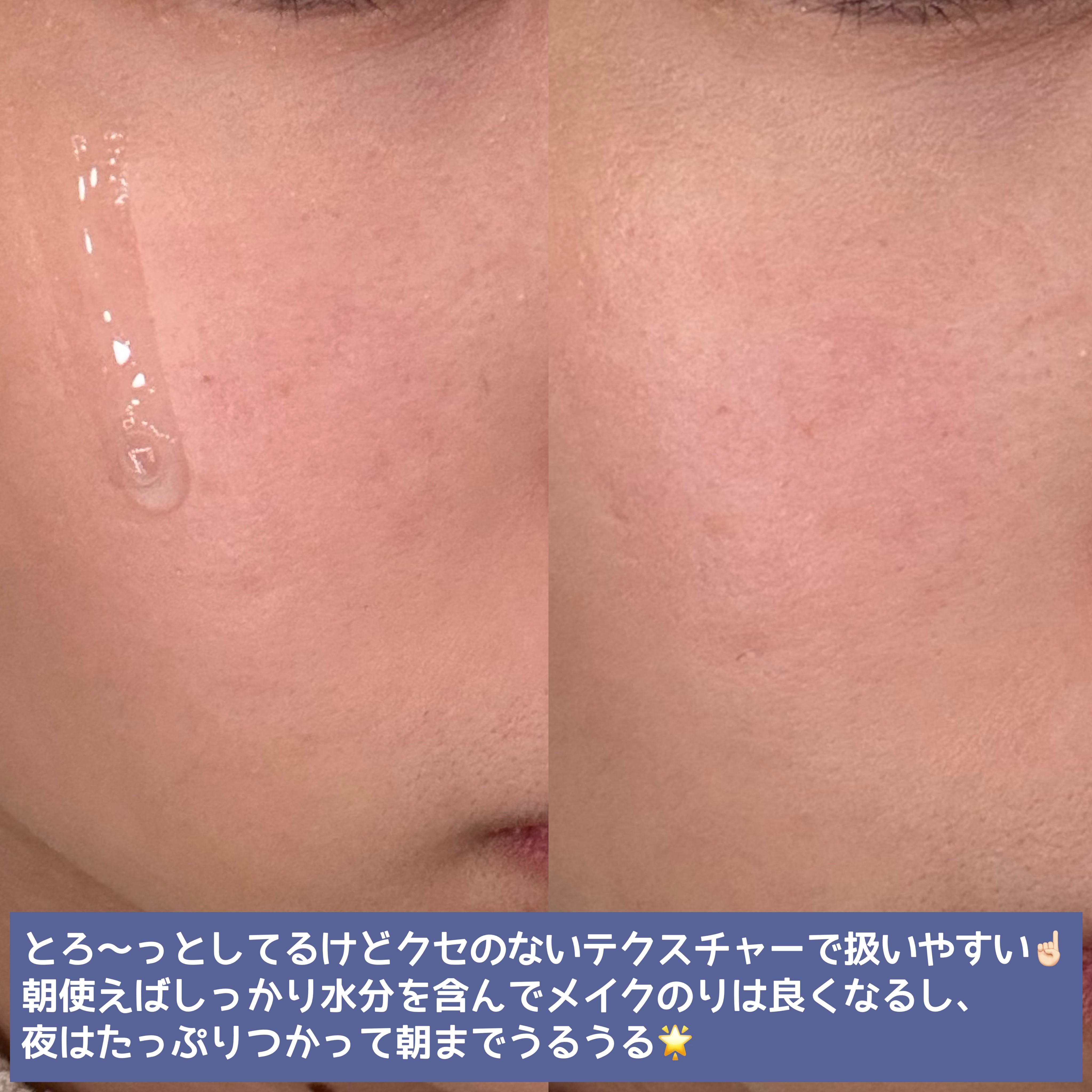 ダイブイン セラム/Torriden/美容液を使ったクチコミ（3枚目）