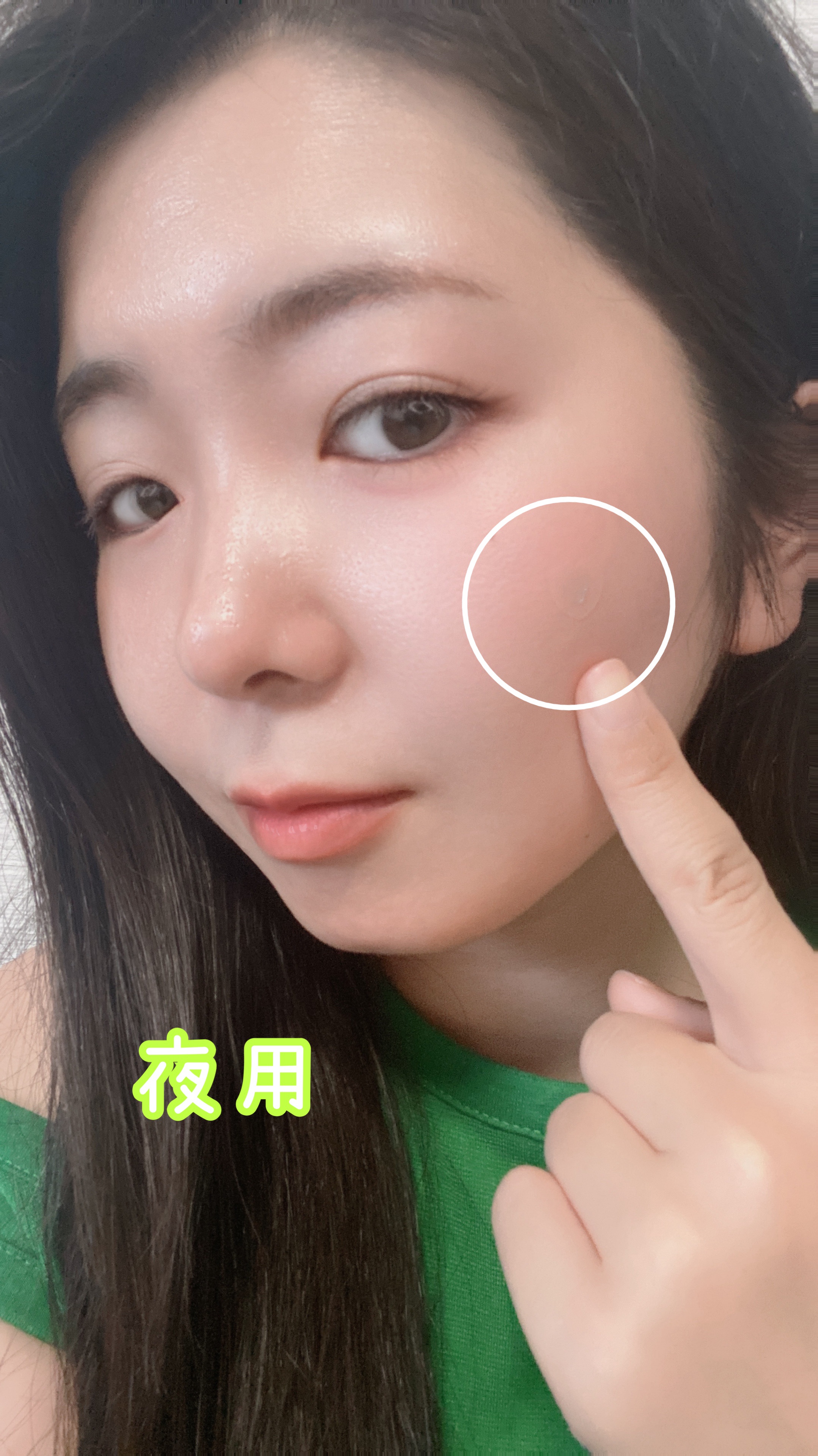 ACマグネシウムパッチ/スノーツープラス/シートマスク・パックを使ったクチコミ（2枚目）