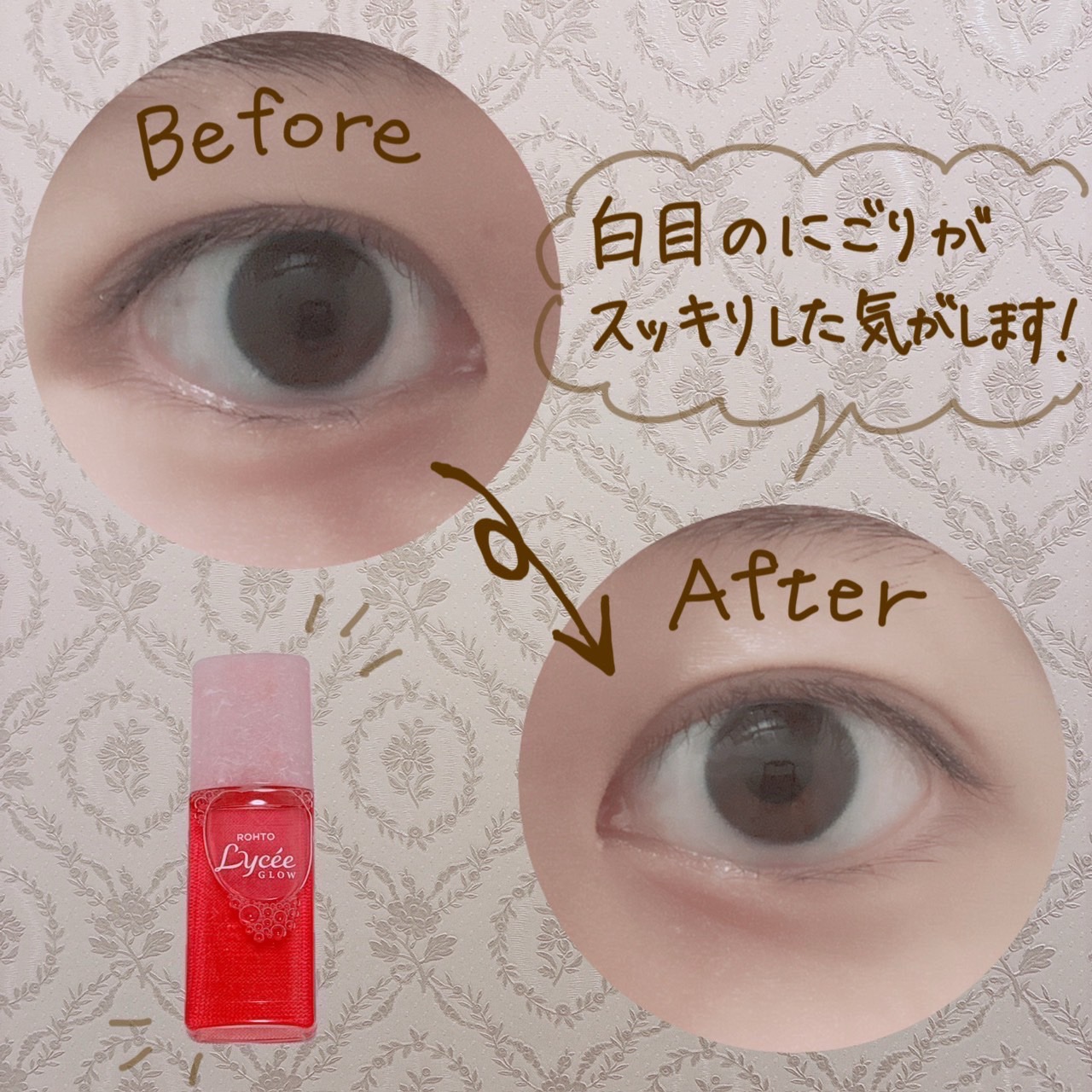 ロートリセグロウ(医薬品)/ロート製薬/その他を使ったクチコミ（3枚目）