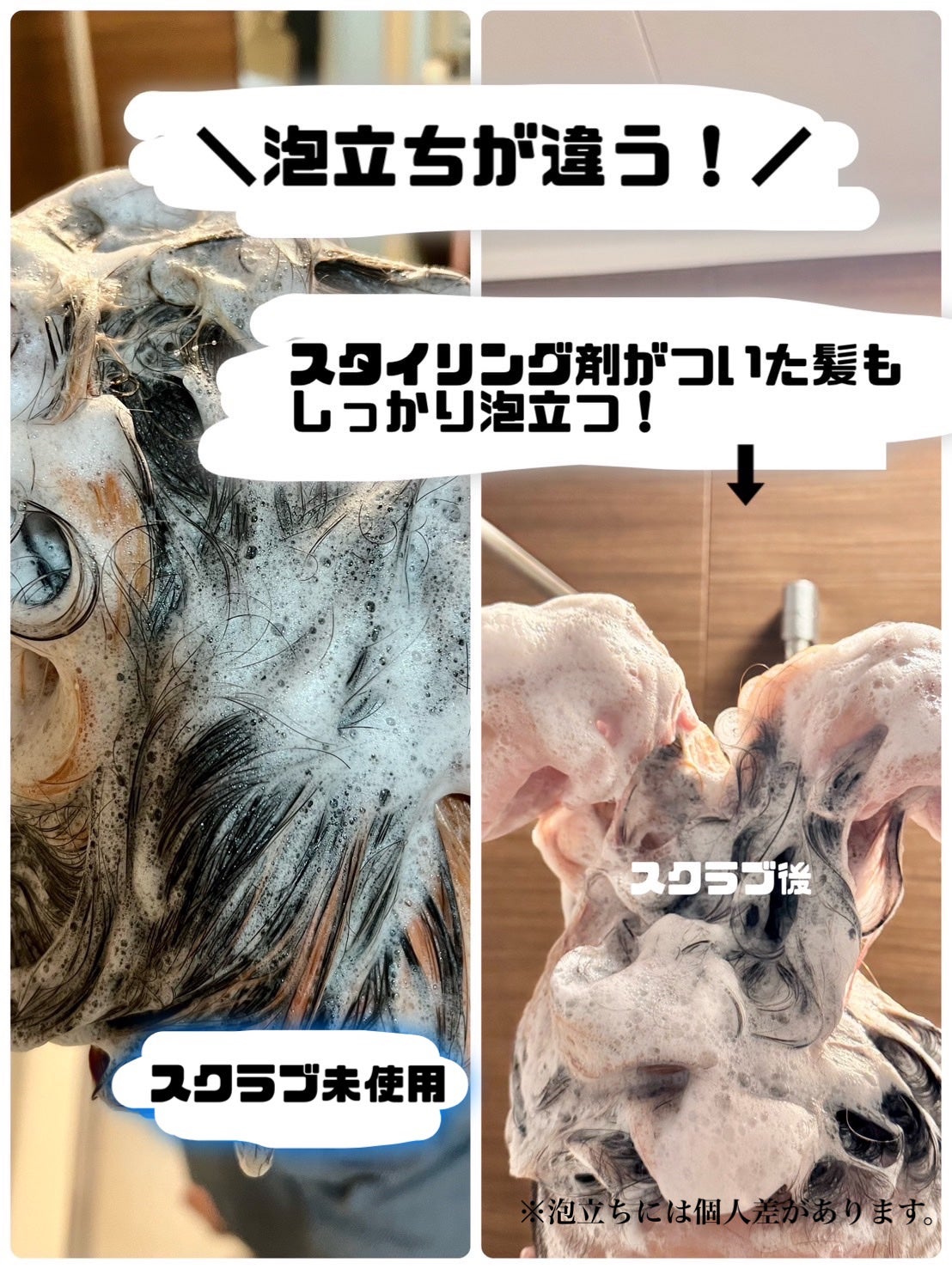 ヘッドスクラブ/shareloù/ヘッドスクラブを使ったクチコミ(1枚目)