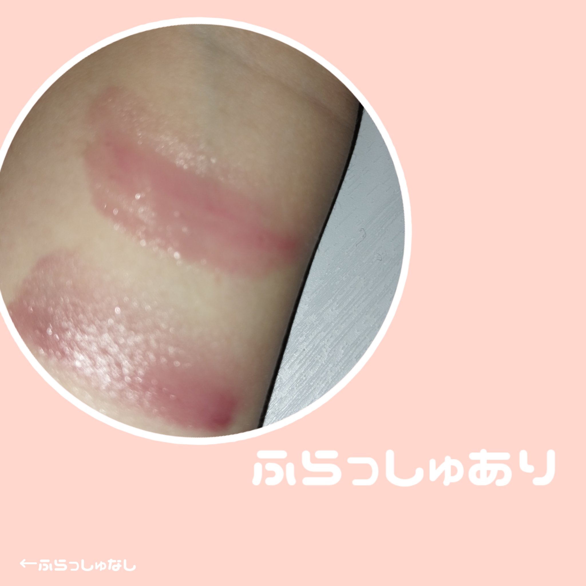 Lip &Cheek Blushing Pendant  03 モーヴジェム/alternativestereo/ジェル・クリームチークを使ったクチコミ（3枚目）