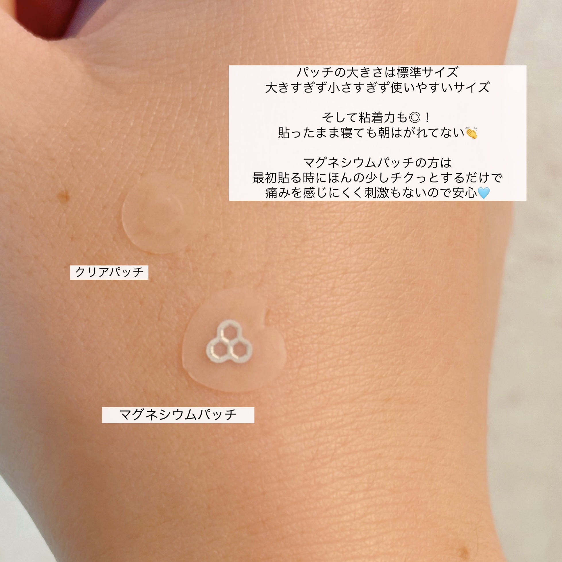 ACマグネシウムパッチ　ミニ/スノーツープラス/にきびパッチを使ったクチコミ（3枚目）