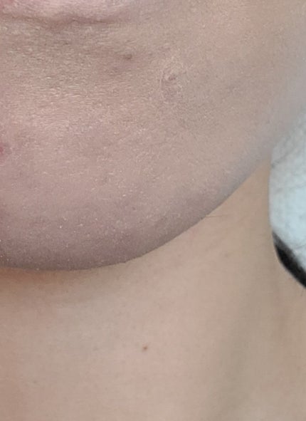 スタジオ フィックス ロングウエア クッション ファンデーション SPF 50/M・A・C/クッションファンデーションを使ったクチコミ(4枚目)