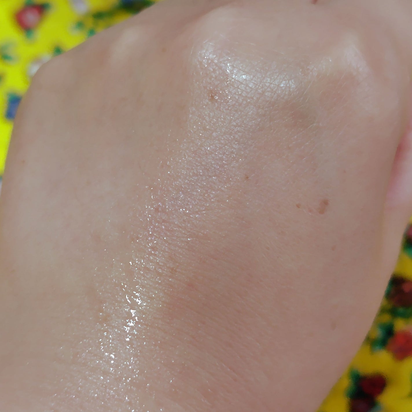 モイストケア ローション MB/d プログラム/化粧水を使ったクチコミ(3枚目)