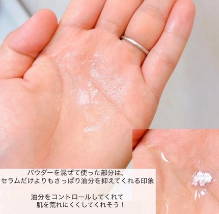 ãžã³ã¯ãã«Bã»ã©ã ã»ãã/BRING GREEN/ã¹ãã³ã±ã¢ãããã䜿ã£ãã¯ãã³ãïŒ5æç®ïŒ