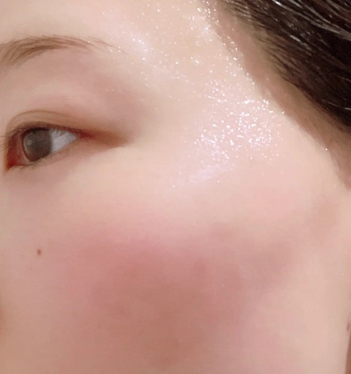 リードルS PDRN+ マスク/VT/シートマスク・パックを使ったクチコミ(4枚目)