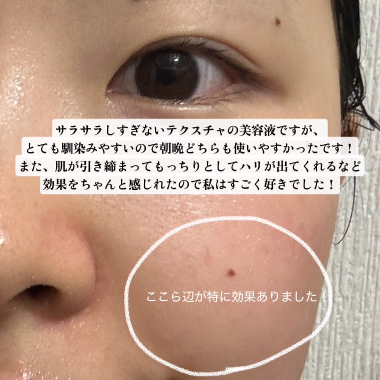 PDRNカフェインショット/IOPE/美容液を使ったクチコミ（3枚目）