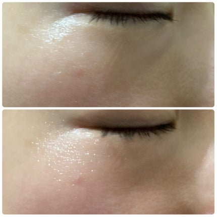 ☆scallop☆フォロバ100%☆ on LIPS 「#毛穴ケアは“隠す”から“育てる”時代へ最近の肌悩みNo.1..」(6枚目)