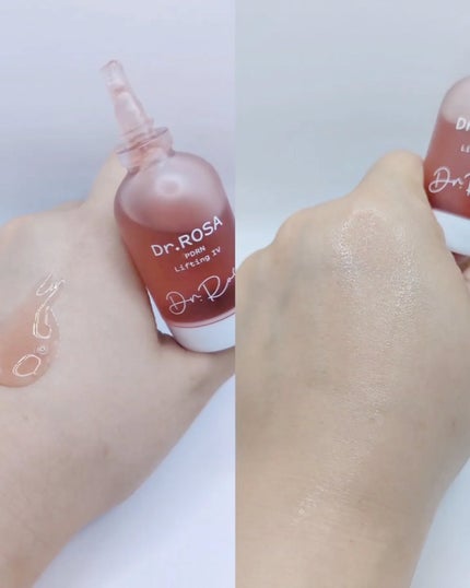 Dr.ROSA IV アンプル3種セット/Dr.ROSA/スキンケアキットを使ったクチコミ(4枚目)