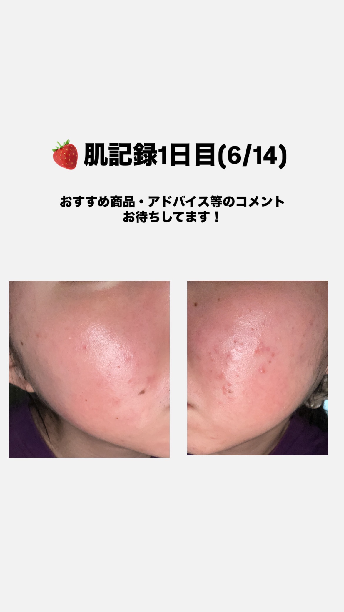 ビタミンB群 30粒/Dear-Natura (ディアナチュラ)/健康サプリメントを使ったクチコミ（1枚目）