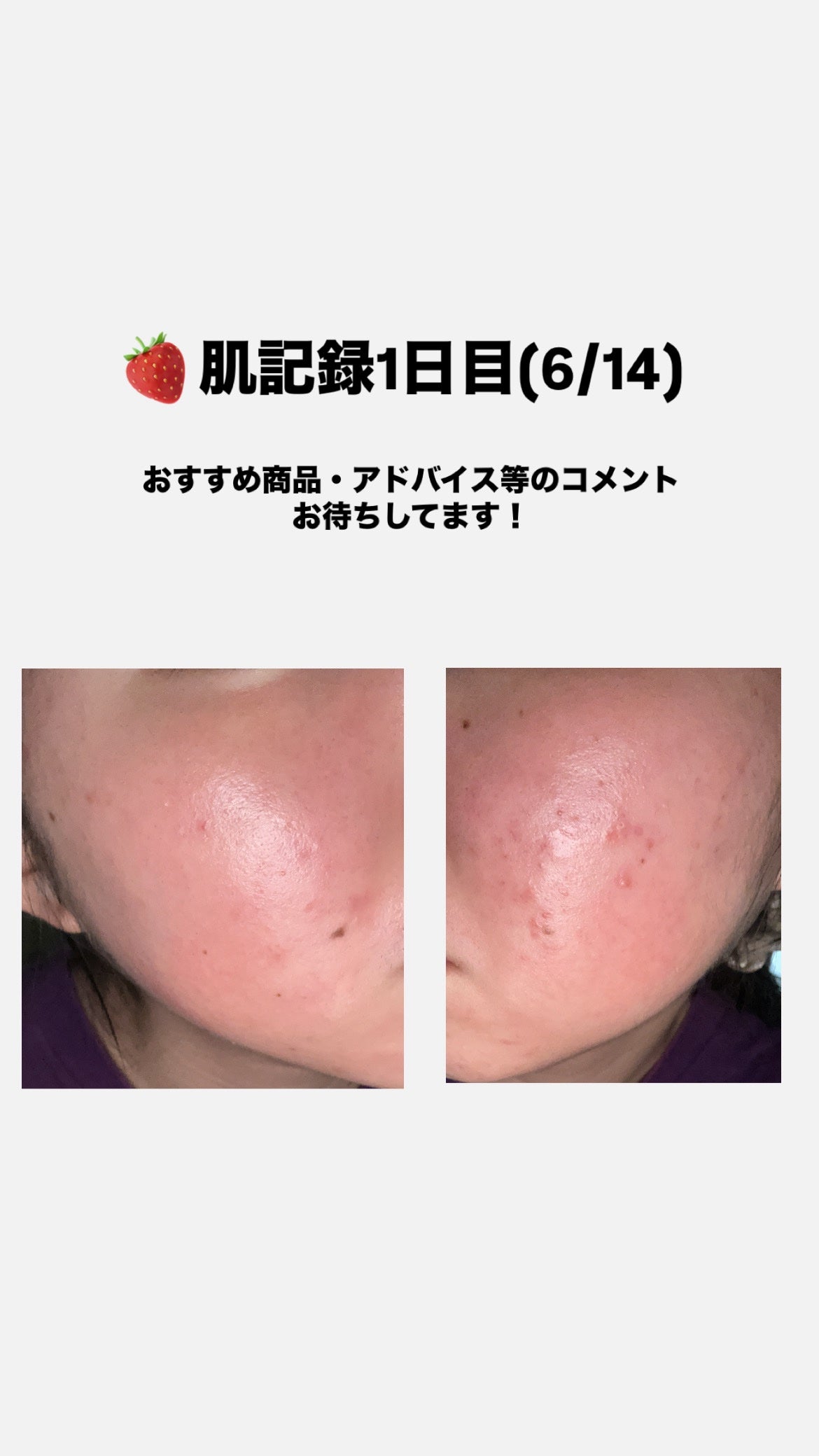 DHC ビタミンCハードカプセル/DHC/美容サプリメントを使ったクチコミ(1枚目)