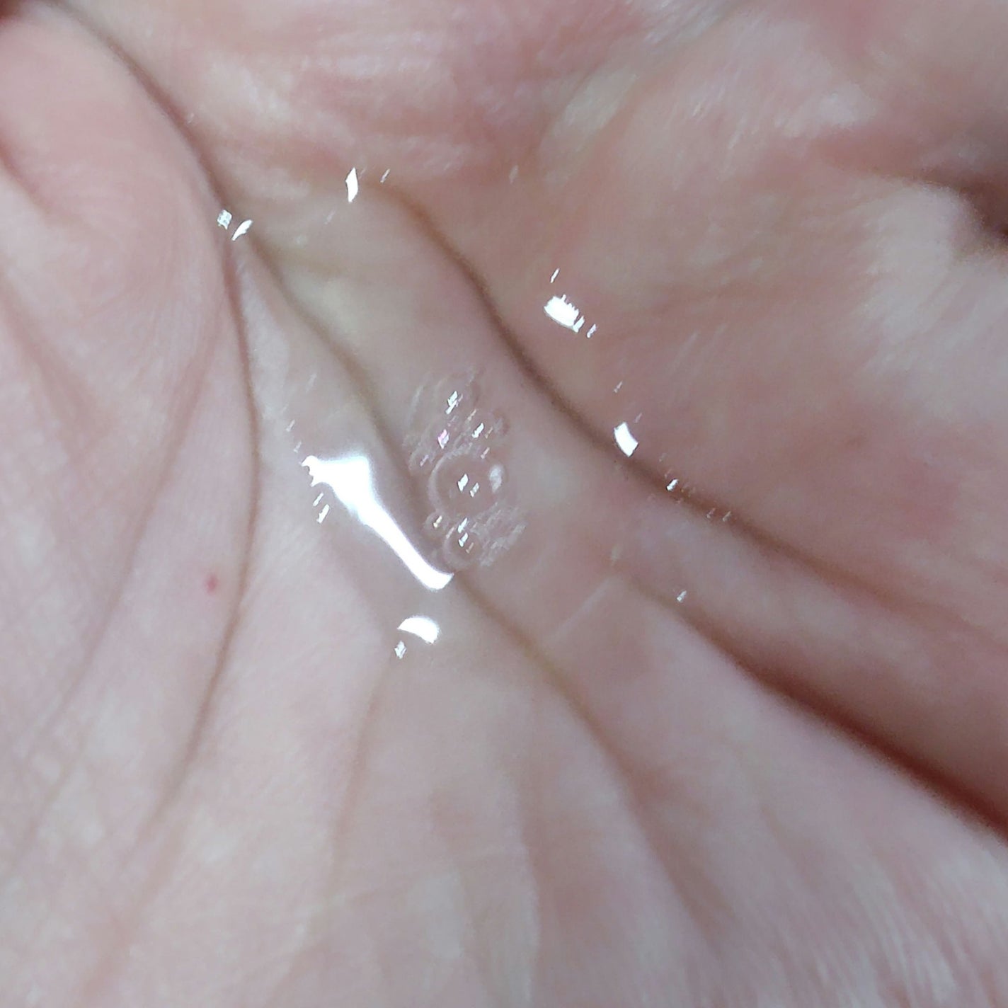 モイストケア ローション MB/d プログラム/化粧水を使ったクチコミ(2枚目)