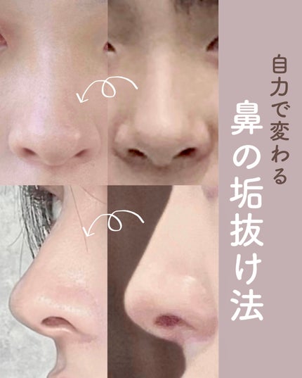 お鼻リフォーマー ハナハナ/グッズマン/その他を使ったクチコミ(1枚目)