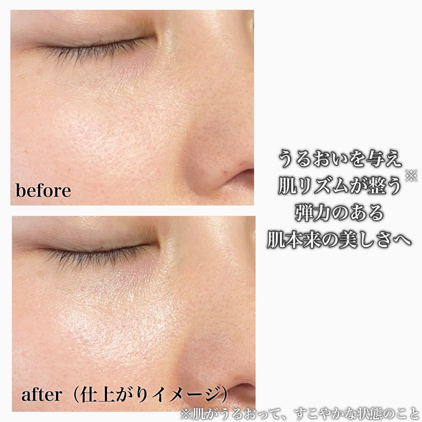 デュアル エフェクト アンプル/REJURAN COSMETICS/美容液を使ったクチコミ(4枚目)