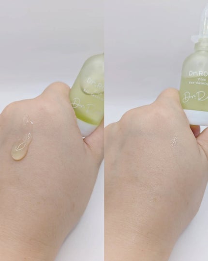 Dr.ROSA IV アンプル3種セット/Dr.ROSA/スキンケアキットを使ったクチコミ(5枚目)