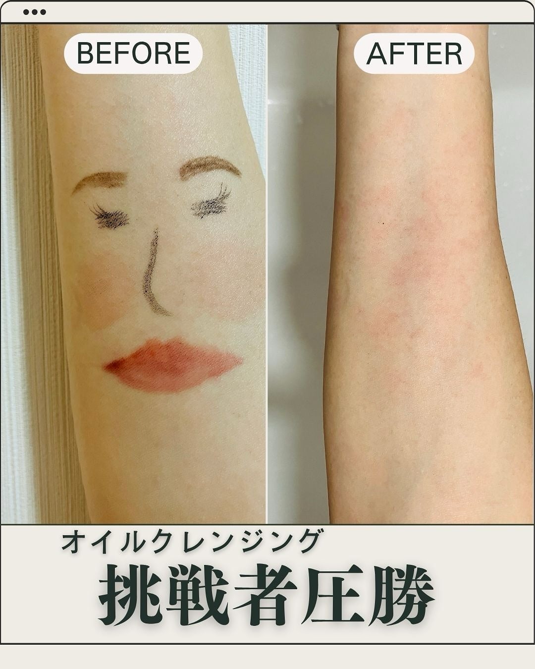 センテラ ライトクレンジングオイル/SKIN1004/オイルクレンジングを使ったクチコミ(6枚目)