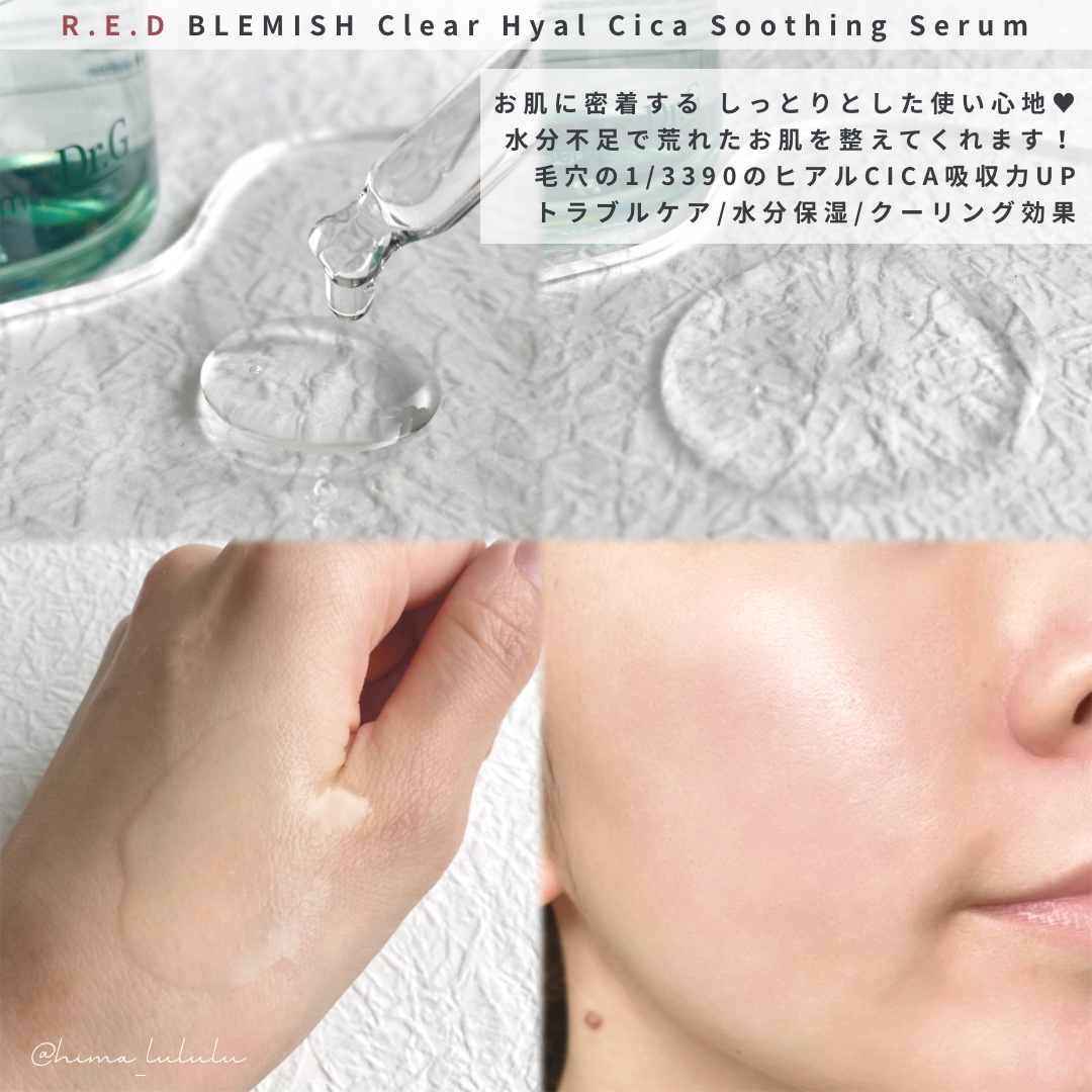 レッドブレミッシュ クリアヒアルシカスージングセラム/Dr.G/美容液を使ったクチコミ（2枚目）