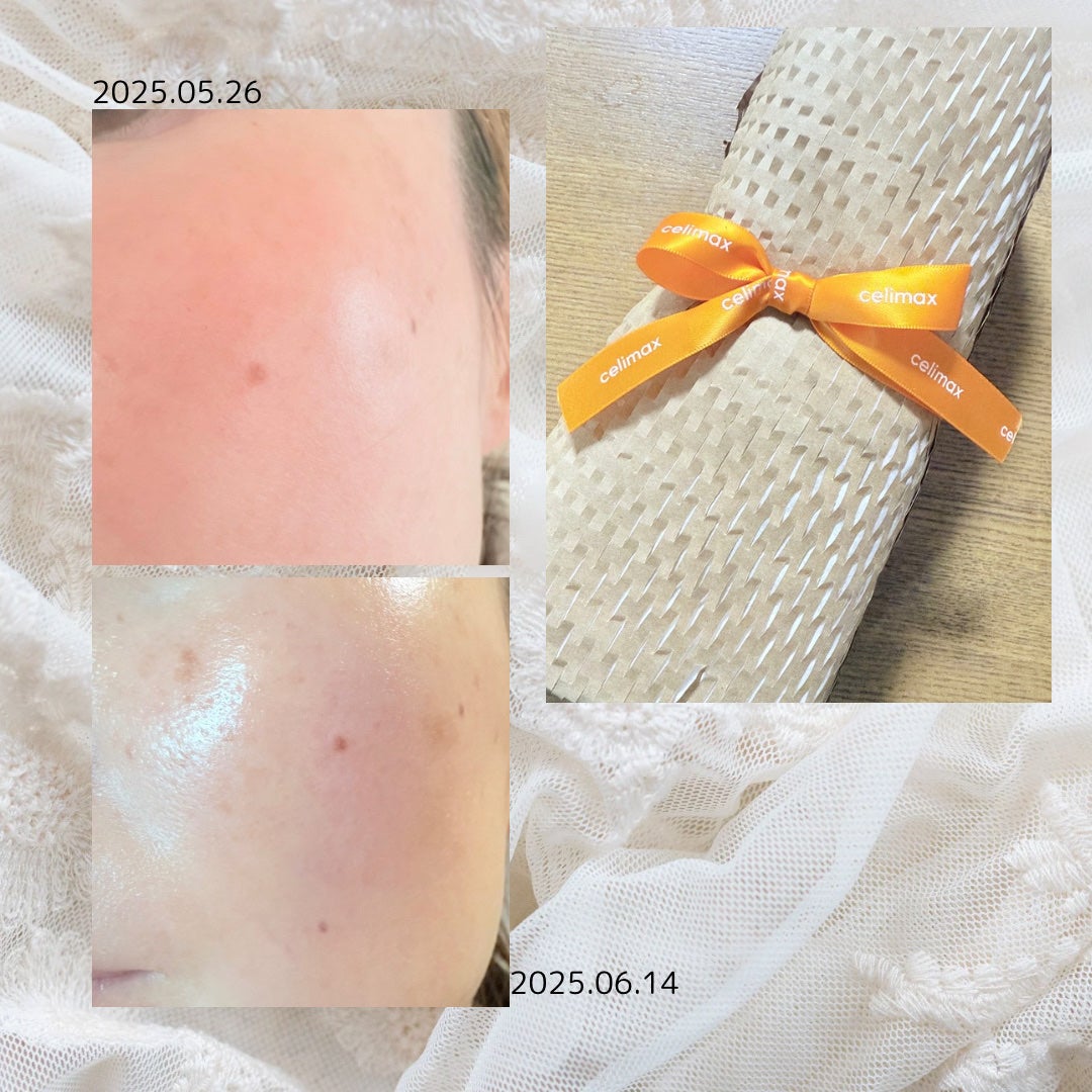 ポア ブライトニング シミケアセラム/celimax/美容液を使ったクチコミ(4枚目)