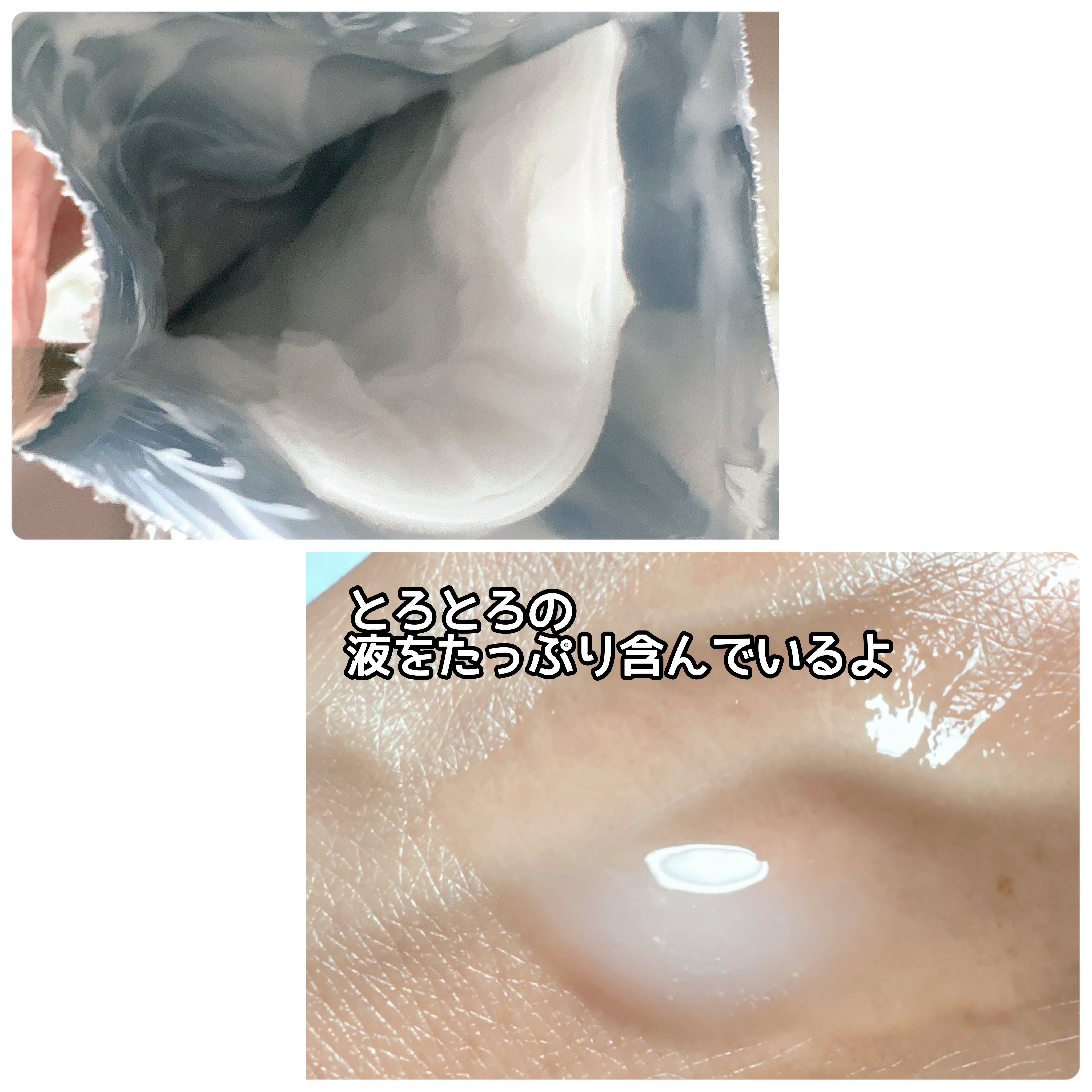 リードルS PDRN+ マスク/VT/シートマスク・パックを使ったクチコミ（2枚目）