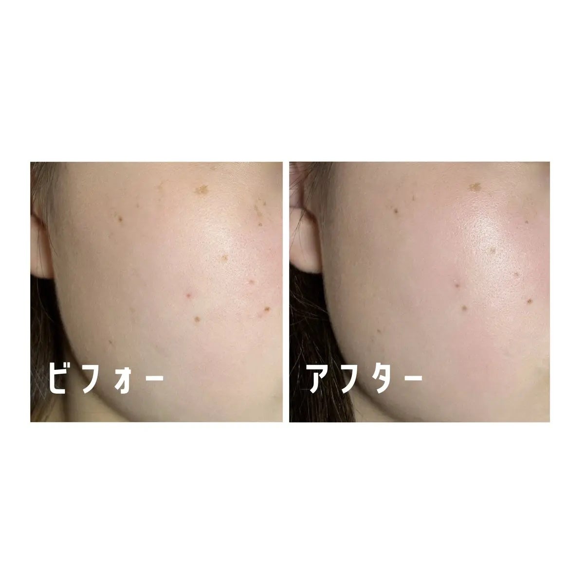 米セラミドエッセンストナー/FULLY/化粧水を使ったクチコミ(2枚目)